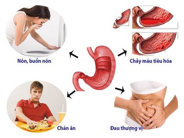 Các bước xoa bóp bấm huyệt massage trị đau bao tử