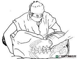 Chữa thoát vị đĩa đệm hiệu quả