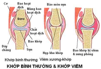 Vitamin C có tác dụng gì cho xương khớp
